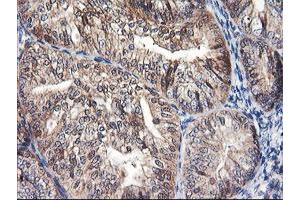 Image no. 10 for anti-F-Box Protein 21 (FBXO21) antibody (ABIN1498232) (FBXO21 antibody)