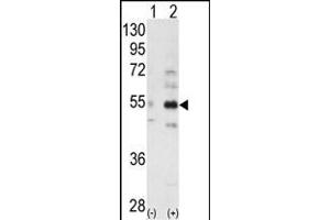 Western blot analysis of ALS2CR2 (arrow) using ALS2CR2 Antibody (C-term ) (ABIN391172 and ABIN2841272). (STRADB antibody  (C-Term))
