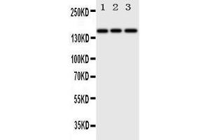 Anti-ErbB 4 antibody, Western blotting Lane 1: HELA Cell Lysate Lane 2: U87 Cell Lysate Lane 3: NEURO Cell Lysate