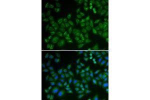 Immunofluorescence analysis of HeLa cells using SMPD1 antibody (ABIN5974079). (SMPD1 antibody)