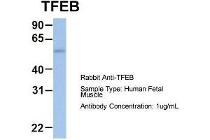 Host: Rabbit  Target Name: TFEB  Sample Tissue: Human Fetal Muscle  Antibody Dilution: 1. (TFEB antibody  (Middle Region))