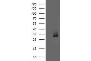 HEK293T cells were transfected with the pCMV6-ENTRY control (Left lane) or pCMV6-ENTRY AQP1 (Right lane) cDNA for 48 hrs and lysed. (Aquaporin 1 antibody)