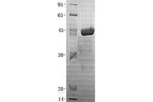 Western Blotting (WB) image for Ubiquitin-Conjugating Enzyme E2H (UBE2H) (Transcript Variant 1) protein (His tag) (ABIN2734844)