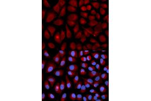 Immunofluorescence analysis of U2OS cells using VIM antibody (ABIN5971408). (Vimentin antibody)