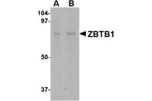 Western blot analysis of ZBTB1 in HepG2 lysate with this product at (A) 1 and (B) 2 μg/ml. (ZBTB1 antibody  (Center))
