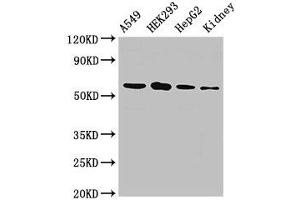 WB analysis of A549 whole cell lysates, HEK293 whole cell lysates, HepG2 whole cell lysates, and Rat Kidney tissue, using P4HA1 antibody (2. (P4HA1 antibody  (AA 256-525))