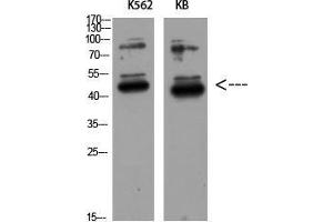 Western Blot (WB) analysis of K562 KB using GDF-3 Polyclonal Antibody diluted at 1:500. (GDF3 antibody  (Internal Region))