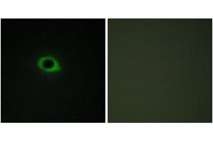 Immunofluorescence analysis of COS7 cells, using TENS3 Antibody. (TNS3 antibody  (AA 541-590))