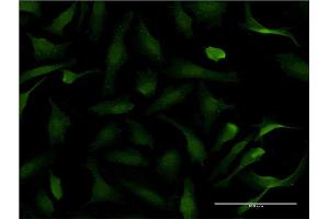 Immunofluorescence of monoclonal antibody to PER2 on HeLa cell. (PER2 antibody  (AA 1-100))
