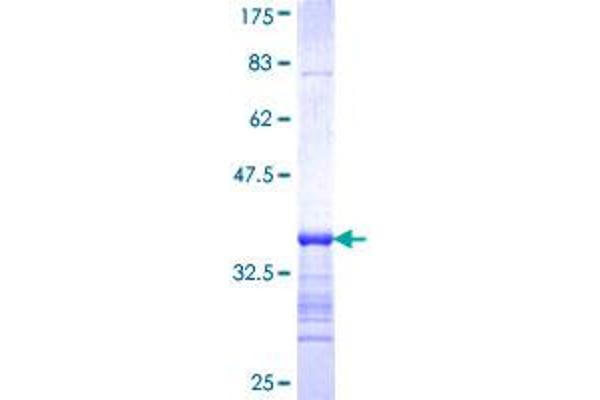 ALDOB Protein (AA 88-170) (GST tag)