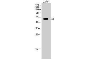 Western Blotting (WB) image for anti-C-Src tyrosine Kinase (CSK) (Ser280) antibody (ABIN3184105) (CSK antibody  (Ser280))