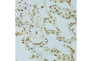 Immunohistochemistry of paraffin-embedded rat lung using RCC1 antibody (ABIN5973761) at dilution of 1/100 (40x lens). (RCC1 antibody)