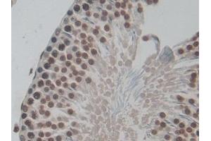 Detection of H3 in Rat Testis Tissue using Polyclonal Antibody to Histone H3 (H3) (Histone 3 antibody  (AA 1-136))