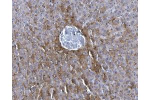 anti-GTP Cyclohydrolase I Feedback Regulator (GCHFR) (AA 2-84) antibody