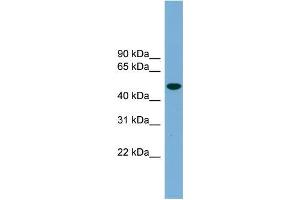 Human 293T; WB Suggested Anti-UBQLNL Antibody Titration: 0. (UBQLNL antibody  (Middle Region))
