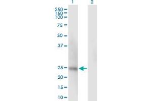 SSU72 antibody  (AA 1-194)