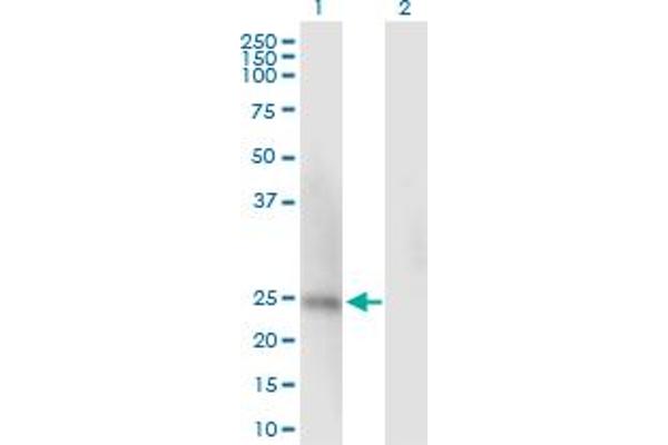 SSU72 antibody  (AA 1-194)