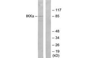 Western blot analysis of extracts from 293 cells, treated with EGF, using IKK-alpha (Ab-23) Antibody. (IKK alpha antibody  (AA 15-64))