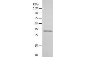 Western Blotting (WB) image for Small Proline-Rich Protein 3 (SPRR3) (AA 99-169) protein (His-IF2DI Tag) (ABIN7283084) (SPRR3 Protein (AA 99-169) (His-IF2DI Tag))