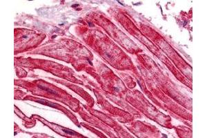 Immunohistochemistry of ILPIP in human heart tissue with ILPIP antibody at 5 μg/ml. (STRADB antibody  (C-Term))
