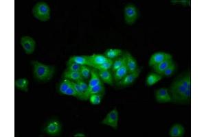 Immunofluorescence staining of HepG2 cells with ABIN7145017 at 1:133, counter-stained with DAPI. (KCNJ1 antibody  (AA 165-379))