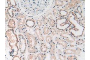 IHC-P analysis of Human Kidney Tissue, with DAB staining. (HMGB1 antibody  (AA 1-215))