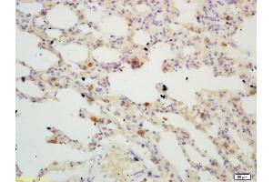 Formalin-fixed and paraffin embedded mouse lung labeled with Rabbit Anti TIGAR Polyclonal Antibody, Unconjugated (ABIN671286) at 1:200 followed by conjugation to the secondary antibody and DAB staining (TIGAR antibody  (AA 161-270))