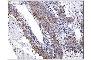 IHC analysis of DLGAP1 using anti-DLGAP1 antibody (ABIN7600257). (DLGAP1 antibody  (AA 17-319))