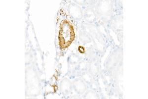 Immunohistochemistry of paraffin-embedded Rat kidney using using SMMHC/MYH11 antibody (ABIN7268745) at dilution of 1:8100 (40x lens). (MYH11 antibody)