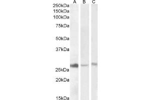 ABIN768557 (1 μg/mL) staining of Human Liver (A), Kidney (B) and -Mouse Liver (C) lysate (35 μg protein in RIPA buffer). (DNAJB9 antibody  (AA 61-75))