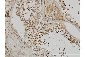 Immunoperoxidase of monoclonal antibody to ACTN4 on formalin-fixed paraffin-embedded human testis. (alpha Actinin 4 antibody  (AA 592-701))