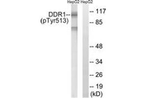 Western blot analysis of extracts from HepG2 cells treated with Na3VO4 0. (DDR1 antibody  (pTyr513))