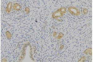 ABIN6276769 at 1/100 staining Human uterus tissue by IHC-P. (Prolactin antibody  (Internal Region))