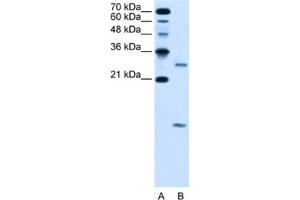 Western Blotting (WB) image for anti-Vacuolar H+-ATPase Homolog (VMA21) antibody (ABIN2463979) (VMA21 antibody)
