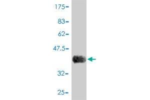 Western Blot detection against Immunogen (42. (RSL24D1 antibody  (AA 1-150))