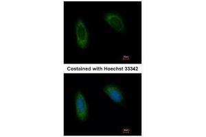 ICC/IF Image Immunofluorescence analysis of methanol-fixed HeLa, using TRAM1, antibody at 1:500 dilution. (TRAM1 antibody  (C-Term))