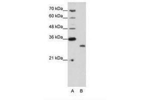 Image no. 1 for anti-CPX Chromosome Region, Candidate 1 (CPXCR1) (N-Term) antibody (ABIN202196) (CPXCR1 antibody  (N-Term))