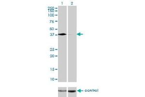 Western blot analysis of PCBP2 over-expressed 293 cell line, cotransfected with PCBP2 Validated Chimera RNAi (Lane 2) or non-transfected control (Lane 1). (PCBP2 antibody  (AA 1-362))