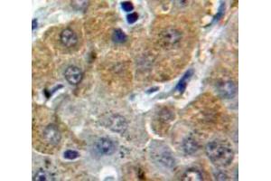 Used in DAB staining on fromalin fixed paraffin-embedded Liver tissue (Afamin antibody  (AA 211-403))