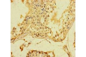 Immunohistochemistry of paraffin-embedded human testis tissue using ABIN7169393 at dilution of 1:100 (SRF antibody  (AA 57-269))