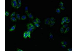 Immunofluorescent analysis of HepG2 cells using ABIN7173071 at dilution of 1:100 and Alexa Fluor 488-congugated AffiniPure Goat Anti-Rabbit IgG(H+L) (TMEM14B antibody  (AA 1-114))