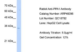 WB Suggested Anti-PPA1 Antibody   Titration: 5.