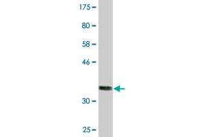 Western Blot detection against Immunogen (36. (Leptin Receptor antibody  (AA 31-130))