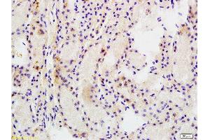 Formalin-fixed and paraffin embedded rat kidney tissue labeled Anti-MRP1 Polyclonal Antibody, Unconjugated  at 1:200, followed by conjugation to the secondary antibody and DAB staining (Multidrug-Resistance Like Protein 1 antibody  (AA 501-600))