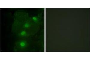 Immunofluorescence analysis of HeLa cells, using ALX3 Antibody. (ALX3 antibody  (AA 171-220))