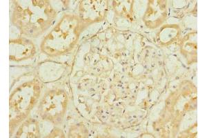Immunohistochemistry (IHC) image for anti-Proliferation-Associated 2G4, 38kDa (PA2G4) (AA 2-394) antibody (ABIN7164746)