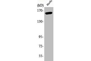 Western Blot analysis of HuvEc cells using Phospho-Flk-1 (Y1175) Polyclonal Antibody (VEGFR2/CD309 antibody  (pTyr1175))
