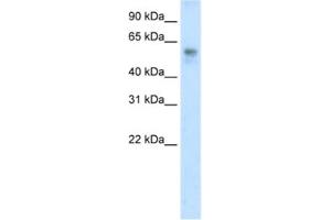 Western Blotting (WB) image for anti-BTB (POZ) Domain Containing 3 (BTBD3) antibody (ABIN2461861) (BTBD3 antibody)