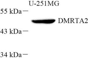 Western blot analysis of DMRTA2 (ABIN7073753) at dilution of 1: 500 (DMRTA2 antibody)