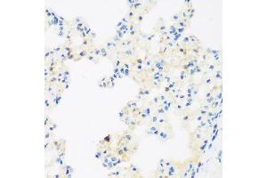 Immunohistochemistry of paraffin-embedded rat lung using NFU1 antibody at dilution of 1:200 (40x lens). (NFU1 antibody)